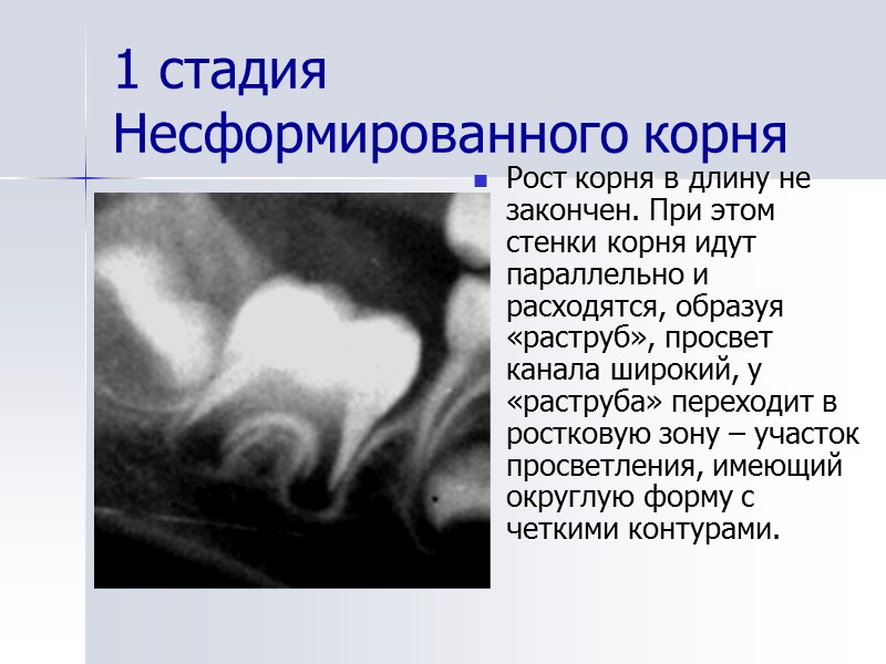 1 стадия  Несформированного корня  Рост корня в длину не закончен. При этом